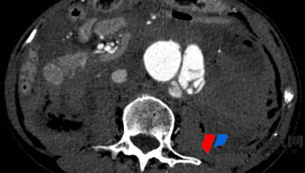 emlog 博客定时发布文章对 SEO 时间因素的影响